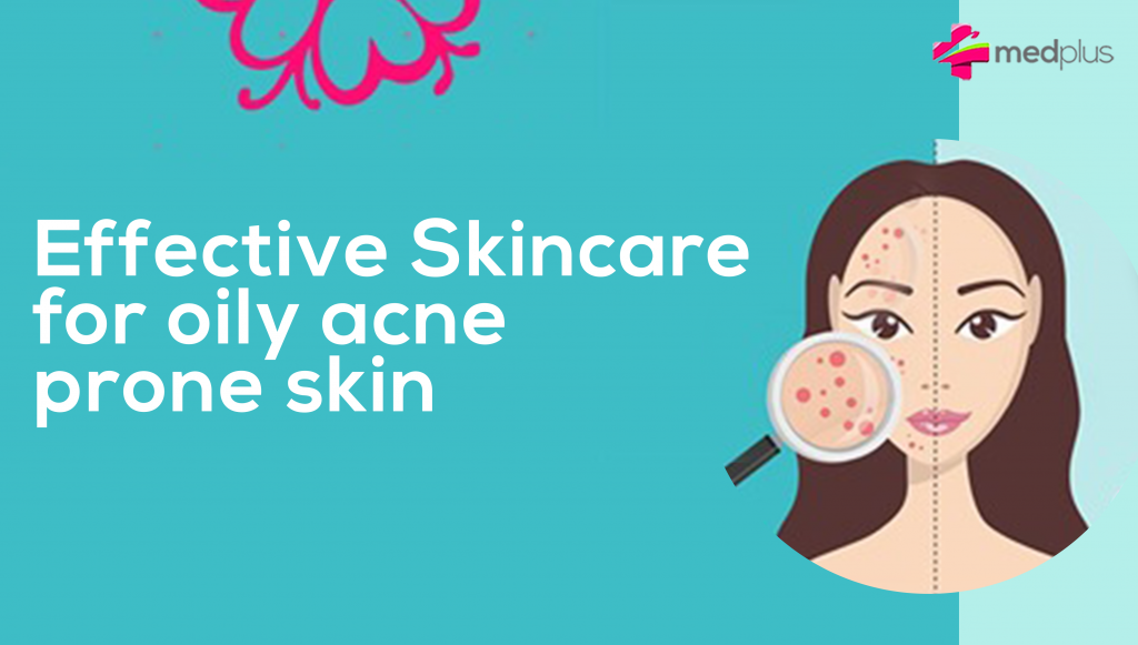 Effective skincare for oily acne-prone skin
