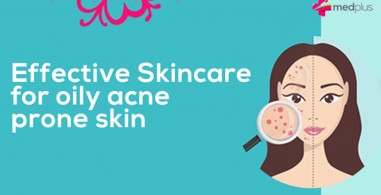 Effective skincare for oily acne-prone skin